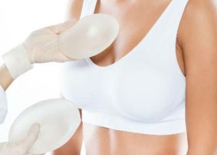 karim-bourra-chirurgie-des-seins-augmentation-mammaire