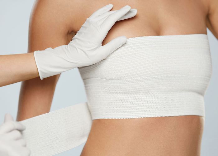 Karim Bourra - Chirurgie des seins - Réduction mammaire