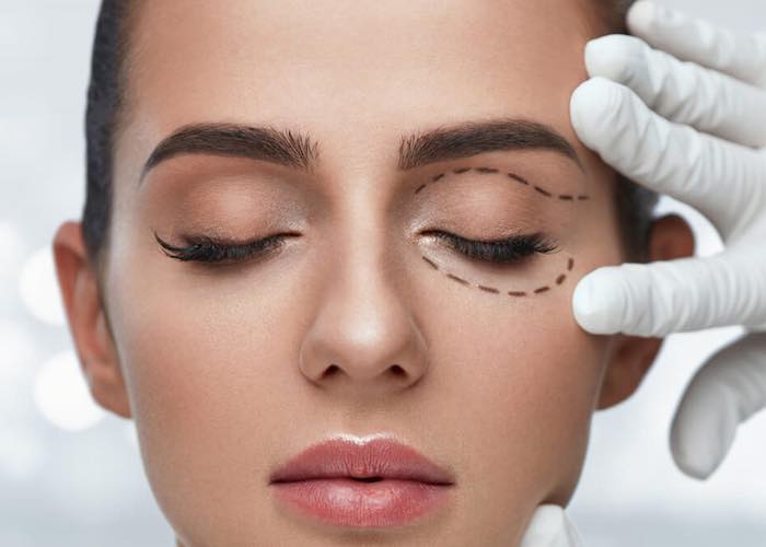 karim-bourra-chirurgie-du-visage-chirurgie-des-paupieres