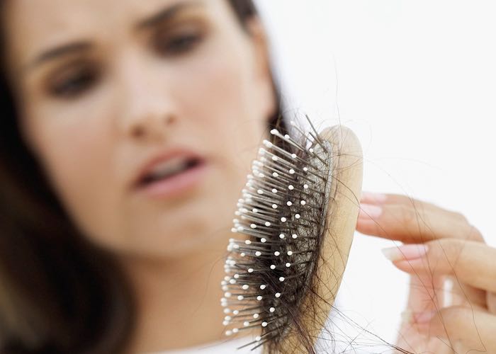 karim-bourra-greffe-capillaire-perte-de-cheveux-feminine