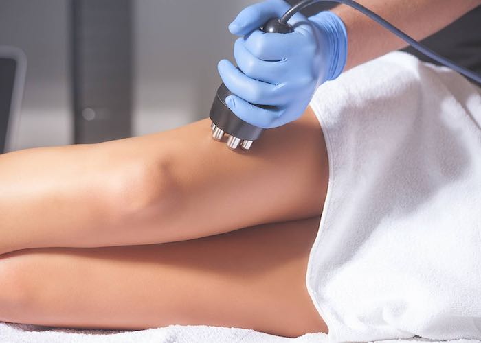 karim-bourra-traitement-de-la-cellulite-radio-frequence