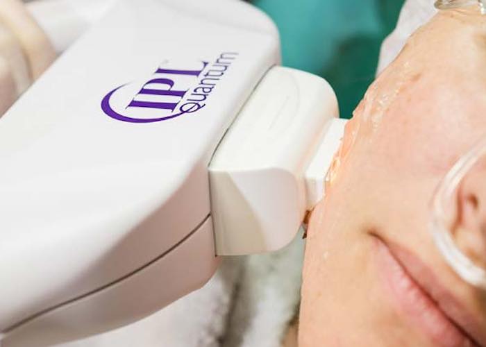 karim-bourra-traitement-des-varices-laser-pigmentaire