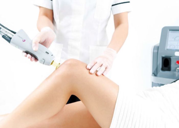 karim-bourra-traitement-des-varices-laser-vasculaire