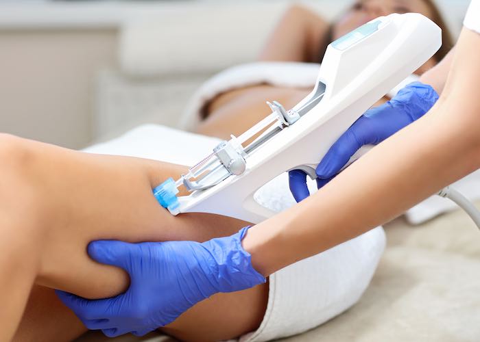 karim-bourra-traitement-des-varices-mesotherapie-cellulite